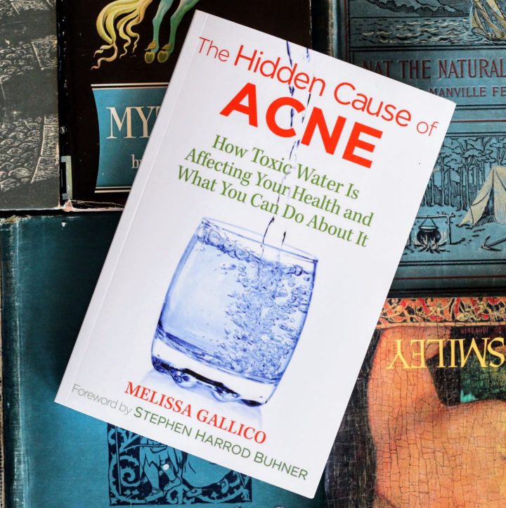 hidden cause of acne book