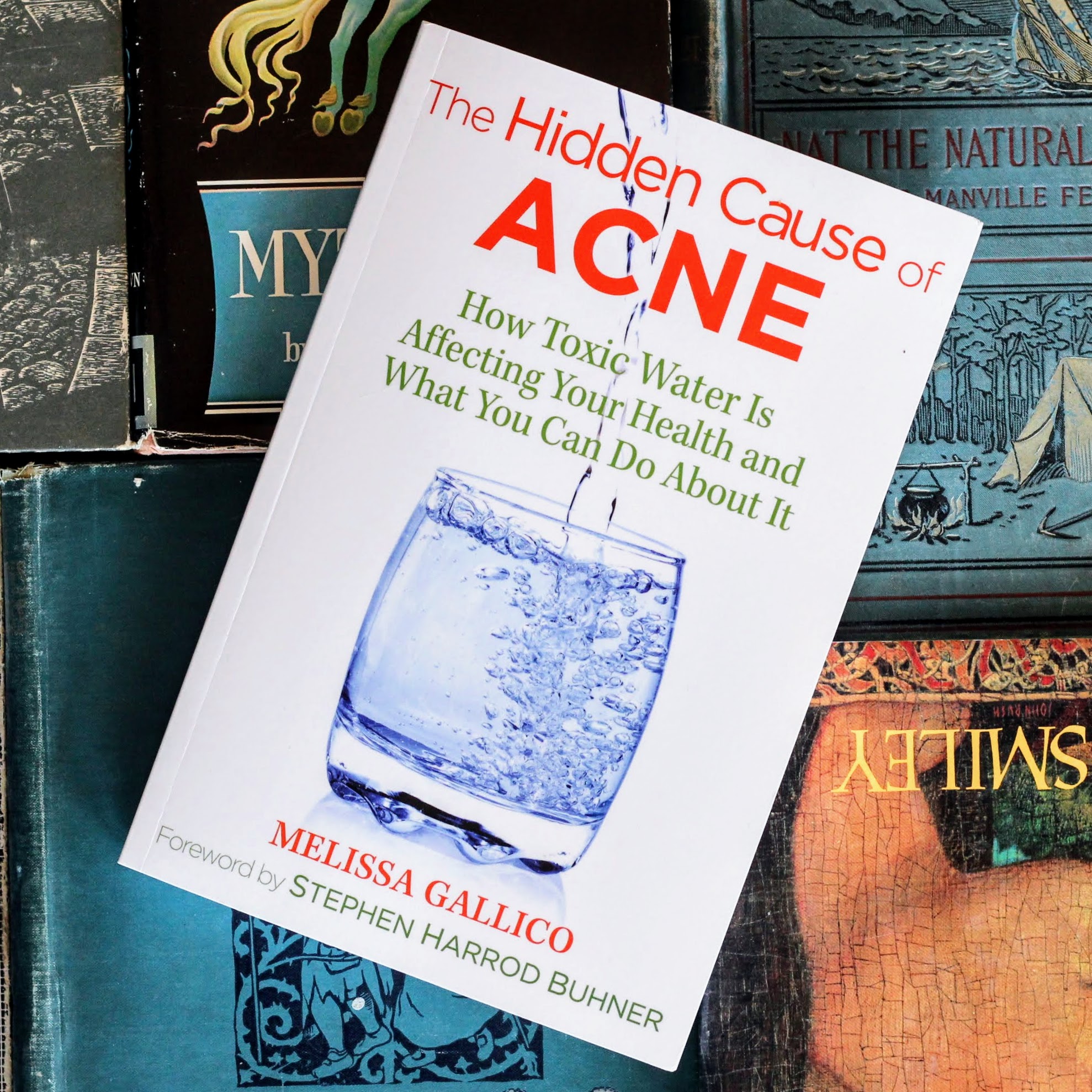 hidden cause of acne book